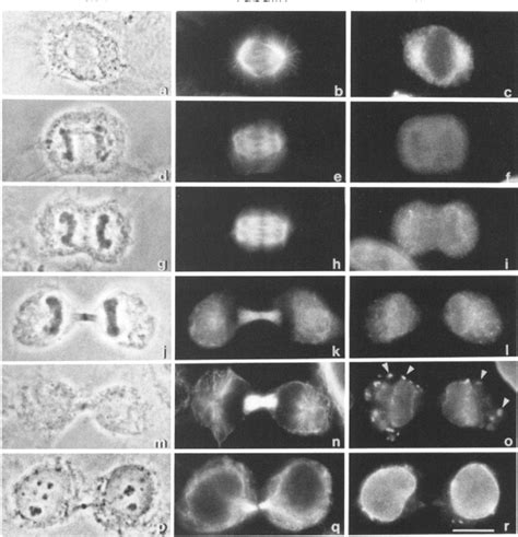 Figure 1 From Stepwise Reassembly Of The Nuclear Envelope At The End Of