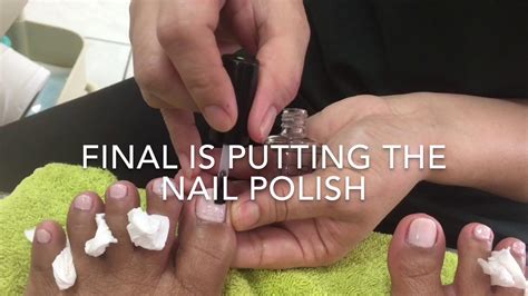 How To Clean A Toe Nail Youtube