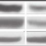 The Expression Of Soluble Guanylyl Cyclase Sgc Is Decreased In The