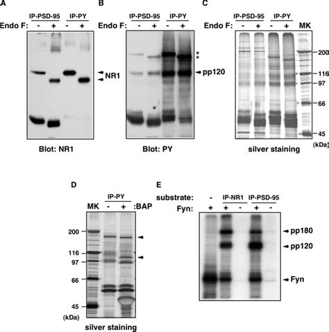 Post Translational Modification Of Pp The Psd Nmda Receptor