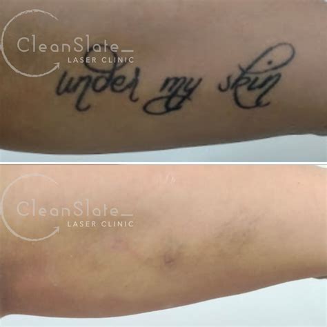 Clean slate tattoo - gaswnot