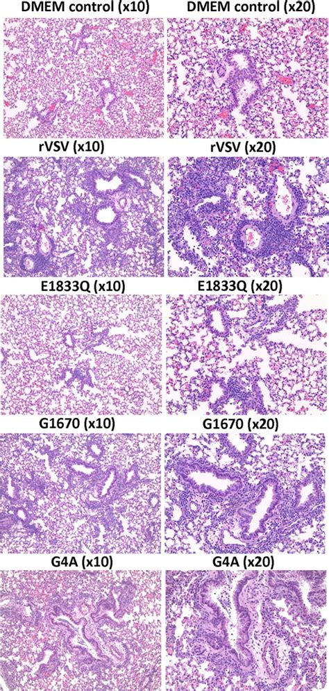 Histopathological Changes In Lungs After Vsv Infection Four Week Old