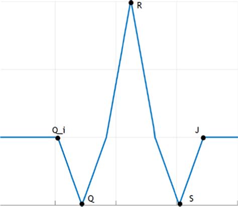 Characteristic points of the QRS complex. | Download Scientific Diagram