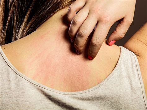 Waking Up With Scratches Causes And Treatment