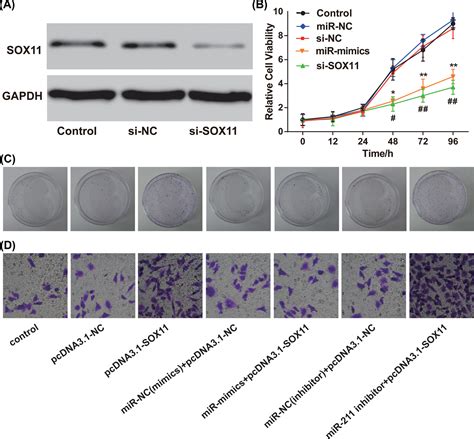 Overexpression Mir‐211‐5p Hinders The Proliferation Migration And Invasion Of Thyroid Tumor