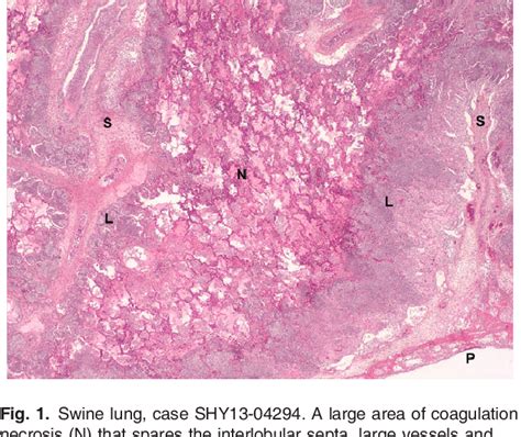 Biofilm Formation By Actinobacillus Pleuropneumoniae Isolates App