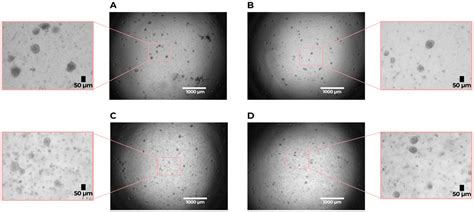 Frontiers Dysregulated Cross Talk Between Alveolar Epithelial Cells