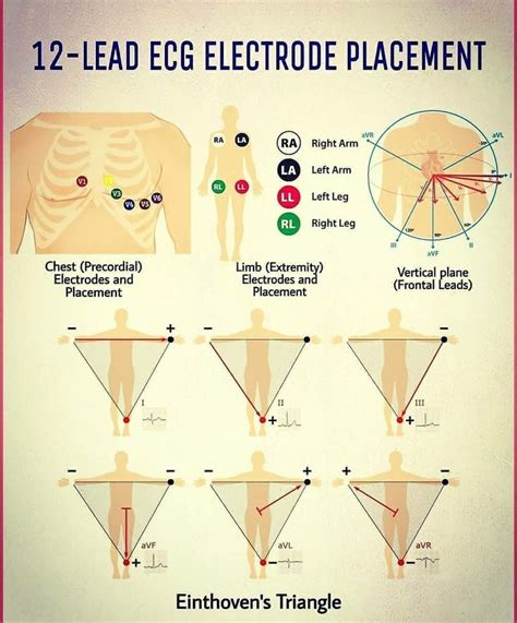 Pin By Cristina Muller On Ekg Medical School Life Medical Assistant