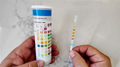 Urs Strip Urinalysis Reagent Test Paper Urine Test Strips Leukocytes