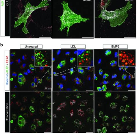 Time Dependent Internalization And Co Localization Of Dii Ldl And