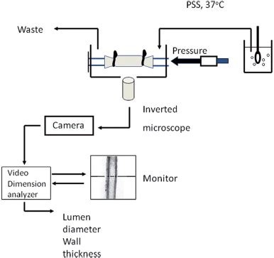 The pressure myograph system. Small arteries are mounted between two ...