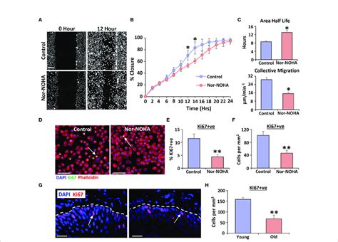 Arginase 1 Inhibition Delays Healing In Human Vaginal Epithelial Cells Download Scientific