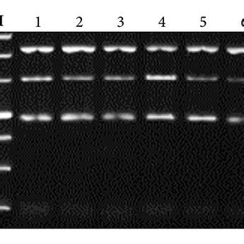 Interaction Effect Of Multiplex PCR Primers M DL2000 DNA Marker 1