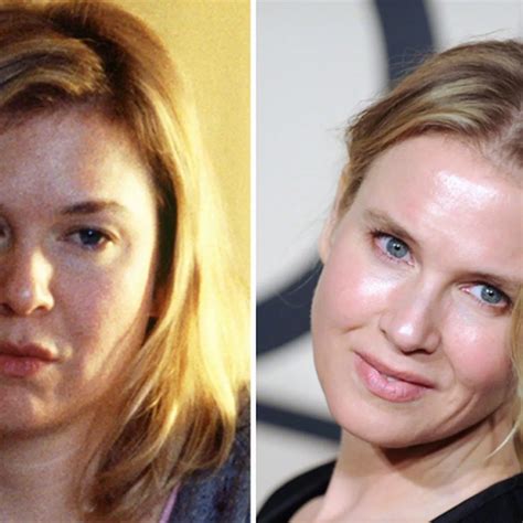 Renee Zellweger Before And After