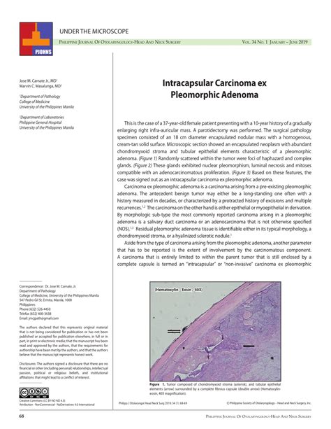 Pdf Intracapsular Carcinoma Ex Pleomorphic Adenoma