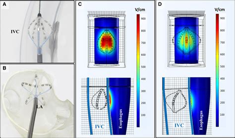 Pulsed Field Ablation Versus Radiofrequency Ablation Circulation