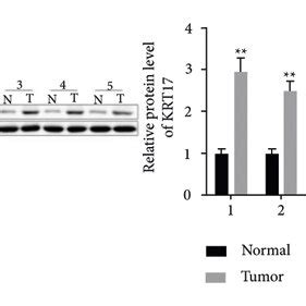 Krt Expression Is Elevated In Lscc Tissues And Cells And Is Linked To