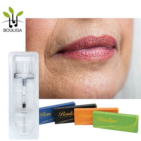 Best Nasolabial Lines Natural Treatment Hyaluronic Acid Injections