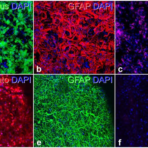 Characterization Cntf Ns And Control Ns Cells Six Weeks After