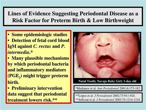 Effect Of Periodontal Infections On Fetal Development And Pregnancy Out