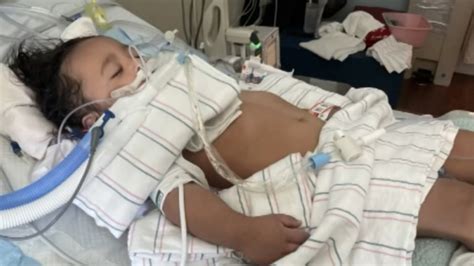 Niño de 18 meses acaba en terapia intensiva tras ser picado por un