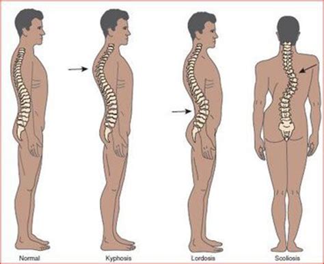 Diseases and Disorders - Skeletal System