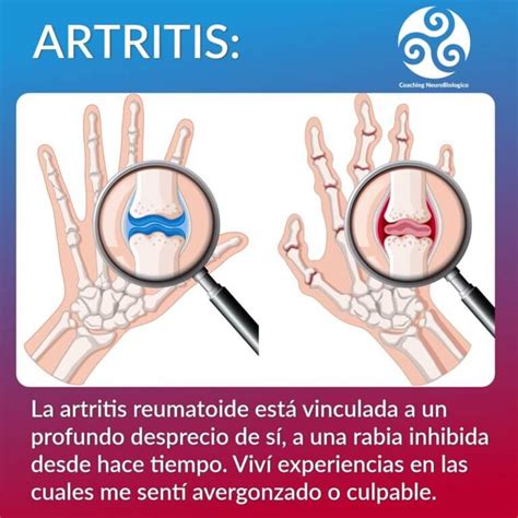 Biodescodificaci N De La Artritis Sanar Las Heridas Coaching De