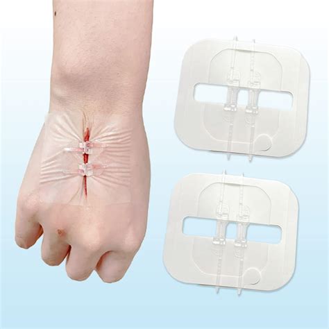 Zip Stitch Sutures X Inches Zipstitch Laceration Closures Kit Bandages