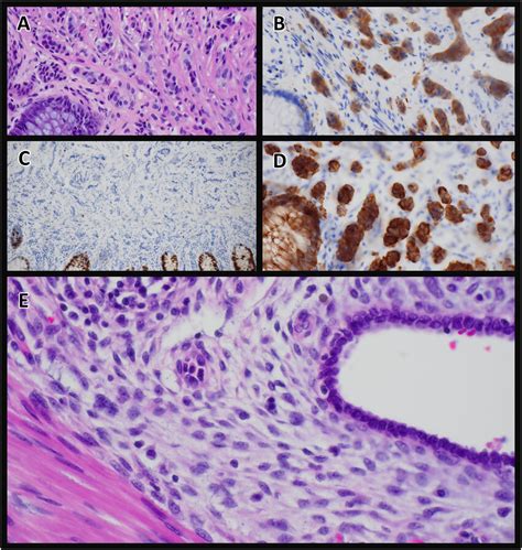 The Histopathologic Examination Of The Resected Specimens A