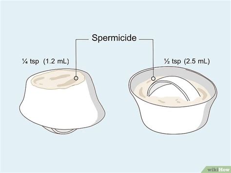 How to Use a Cervical Cap - wikiHow