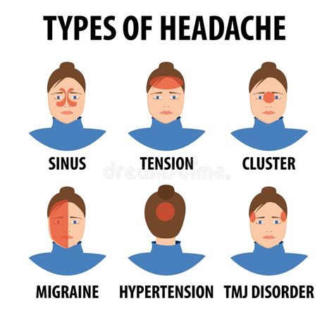 Tipos De Cefaleias De Cartografia Tensão Enxaqueca Sinus Aglomerado
