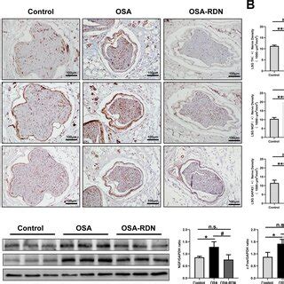 A, B Representative immunohistochemical images and semi-quantitative ... 