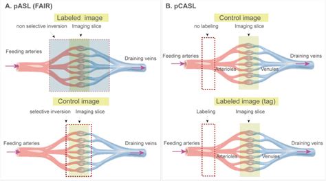 Fig 2 Basic Principle Of Arterial Spin Preclinical Mri Of The