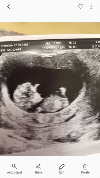 Gender Guesses Please 12 Week Scan Mumsnet