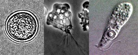 Naegleria Fowleri Amoeba -Characteristics/Symptoms/Treatment/Infection