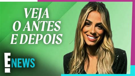 Key Alves do BBB 23 faz harmonização facial Veja o antes e depois