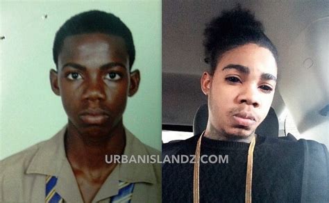 Alkaline Bleaching Before And After Photo Goes Viral Urban Islandz