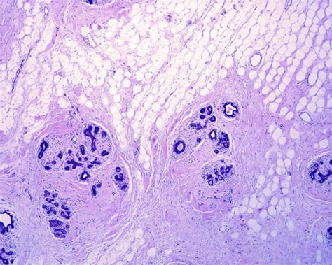 Human Breast Gland Stock Image Image Of Terminal Lobular 232081187