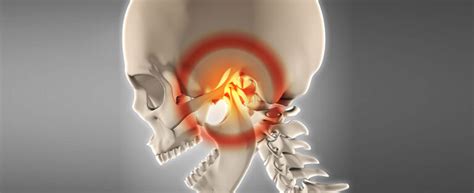 What Is Temporomandibular Disorder Tmd Dentistry And Aesthetics In