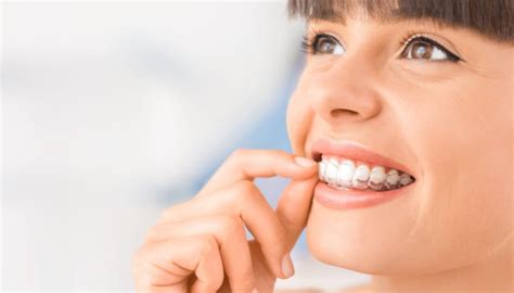 Para qué sirven los ataches de Invisalign