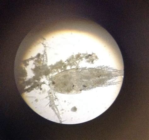 Identifying Pond Water Microorganisms As Bioindicators Science By Sinai