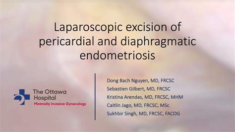 Excision Of Pericardial And Diaphragmatic Endometriosis