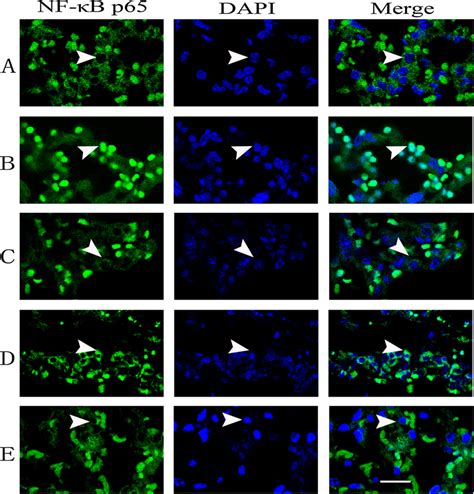 Effects of NNAV on the nuclear translocation of NF κB in the lung