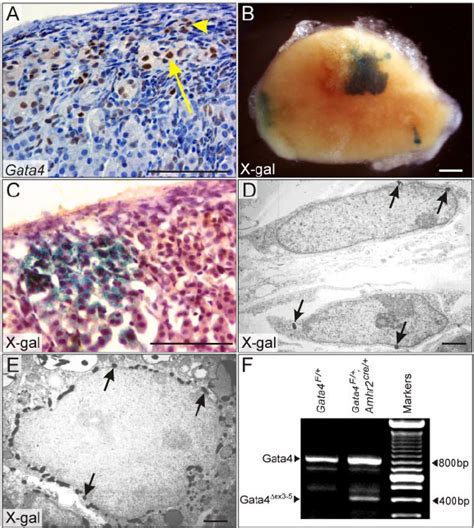 Ovariectomized B6129 Mice Develop Adrenocortical Neoplasms That Download Scientific Diagram