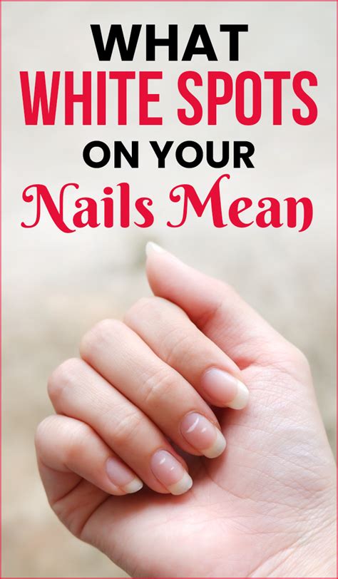 What Do Brown Spots On Your Nails Mean Design Talk