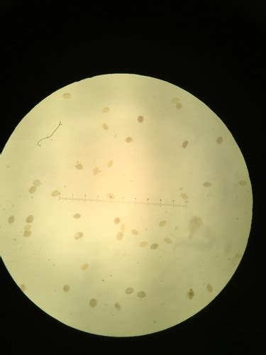 Parasitology Nematodes Trematodes Flashcards Quizlet