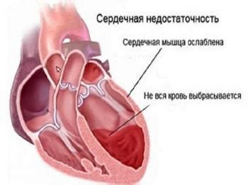 Юперио - инструкция по применению, описание, отзывы пациентов и врачей ...