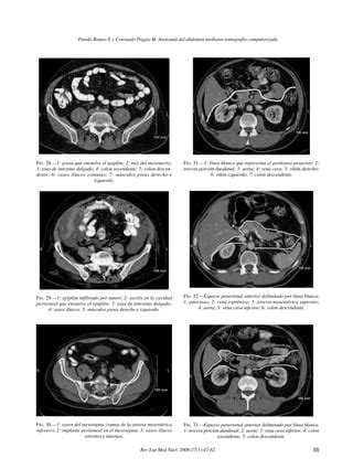 Lectura De Anatomia Tomografica Del Abdomen Y Pelvis Pdf