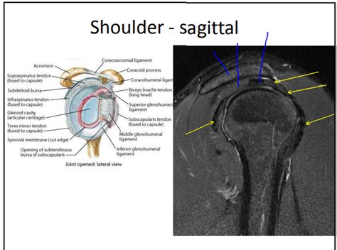 Lec 39 Git Imaging Of Musculoskeletal System Shoulder Sagittal View Mri Diagram Quizlet