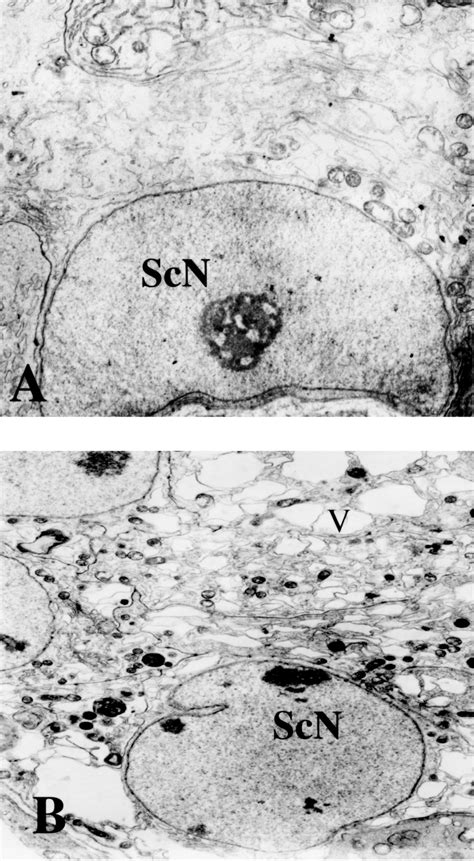 Transmission Electron Micrographs Of Sertoli Cells In Control And Mehp